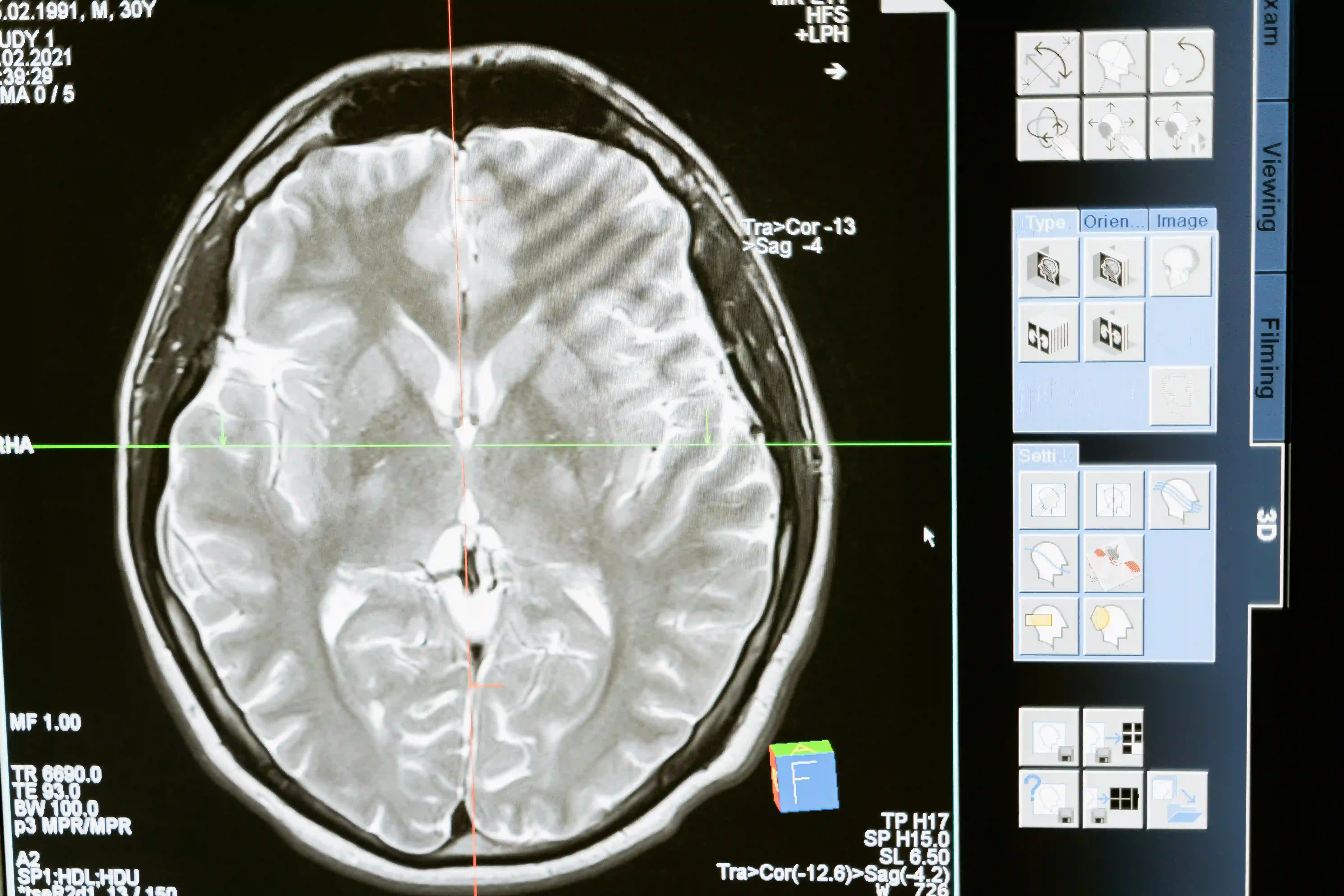 Innovations in Neurological Surgery